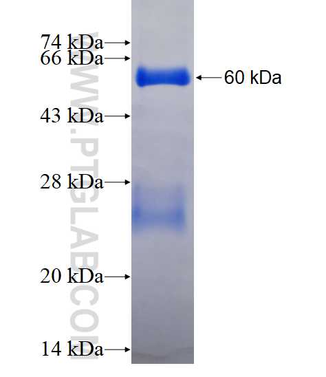 SAMD4B fusion protein Ag12113 SDS-PAGE
