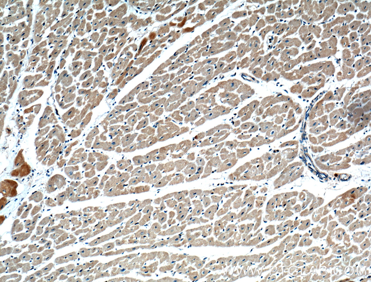 Immunohistochemistry (IHC) staining of human heart tissue using SAMD8 Polyclonal antibody (26815-1-AP)