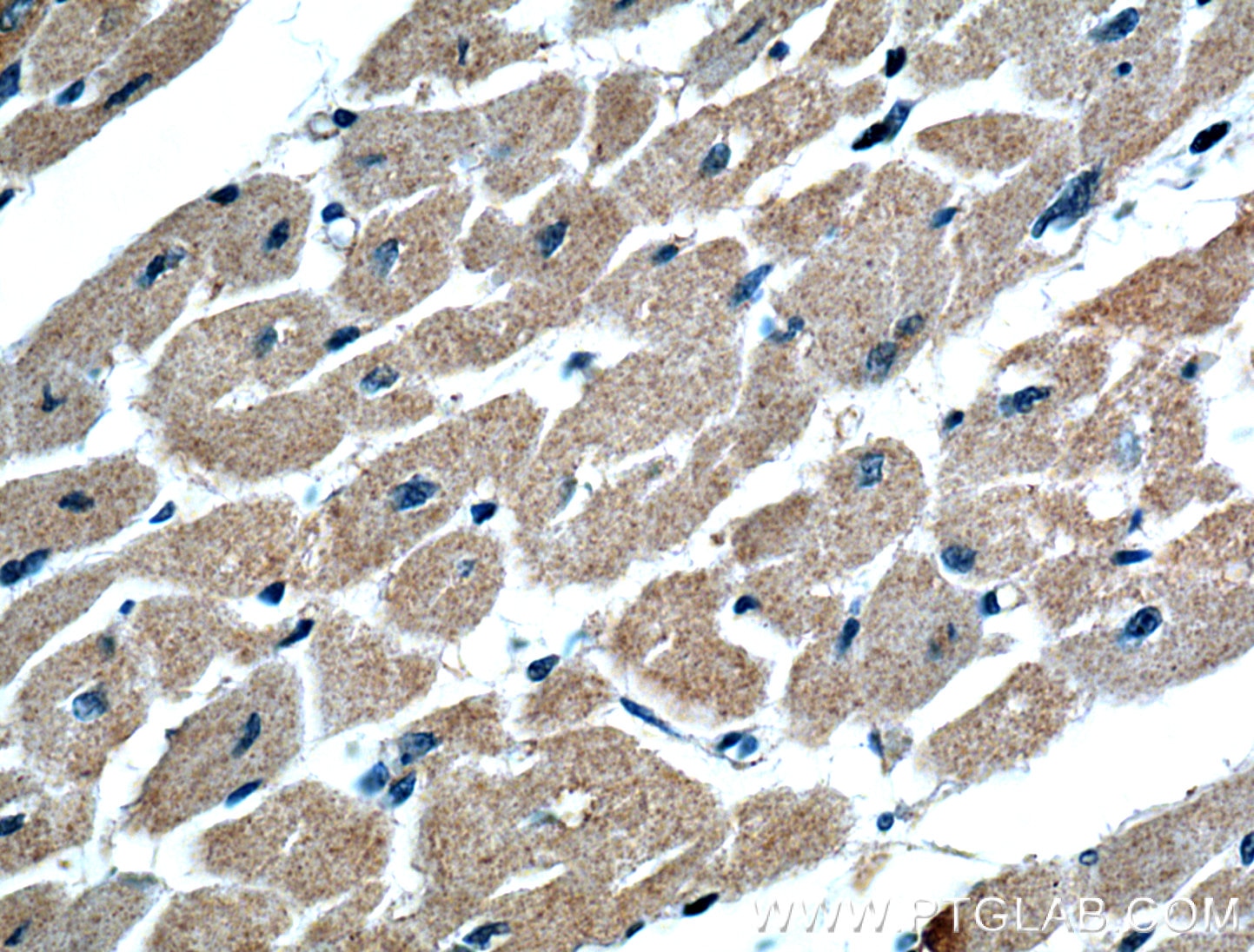 Immunohistochemistry (IHC) staining of human heart tissue using SAMD8 Polyclonal antibody (26815-1-AP)