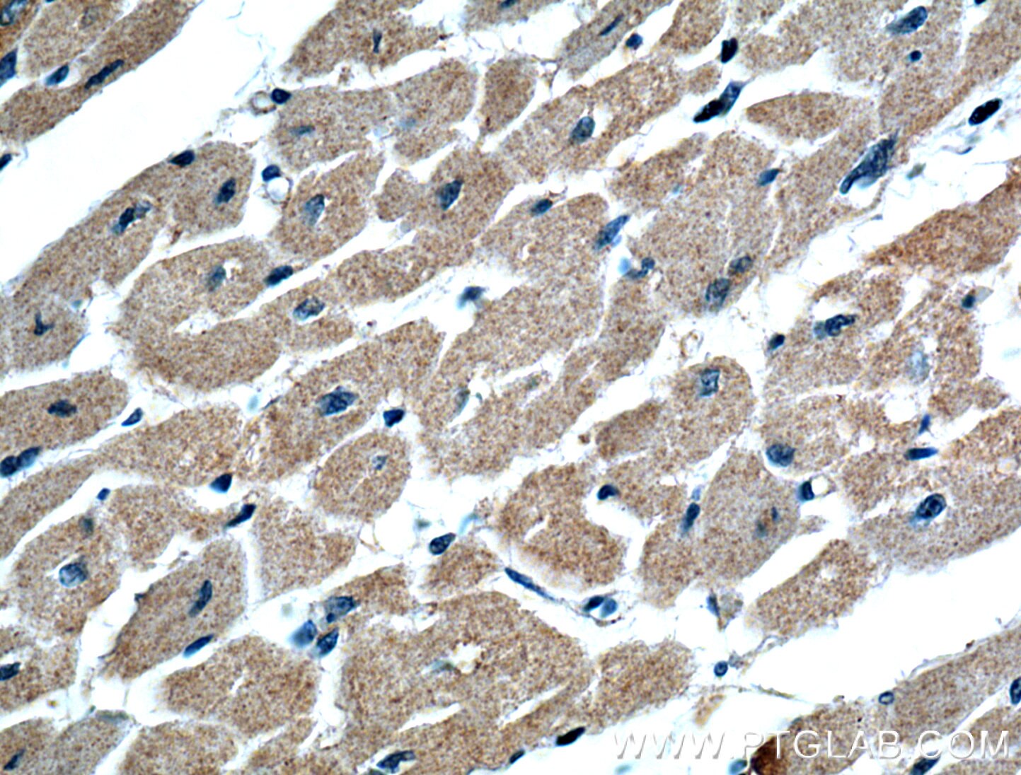 IHC staining of human heart using 26815-1-AP