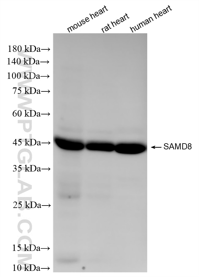 WB analysis using 86670-1-RR (same clone as 86670-1-PBS) Western Blot (WB) analysis of various lysates using SAMD8 Recombinant monoclonal antibody (86670-1-RR)