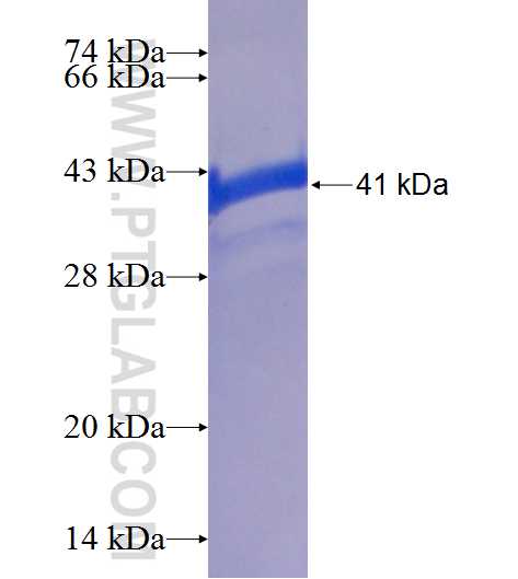 SAMD8 fusion protein Ag25310 SDS-PAGE