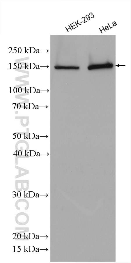 Western Blot (WB) analysis of various lysates using SAMD9 Polyclonal antibody (22786-1-AP)