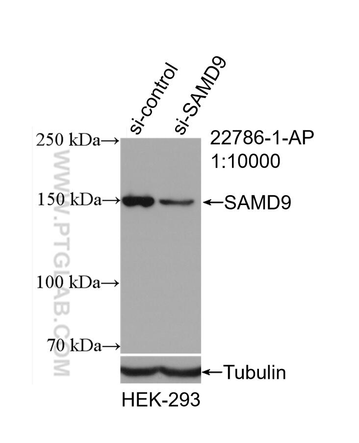 Western Blot (WB) analysis of HEK-293 cells using SAMD9 Polyclonal antibody (22786-1-AP)