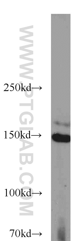 Western Blot (WB) analysis of HEK-293 cells using SAMD9 Polyclonal antibody (22786-1-AP)