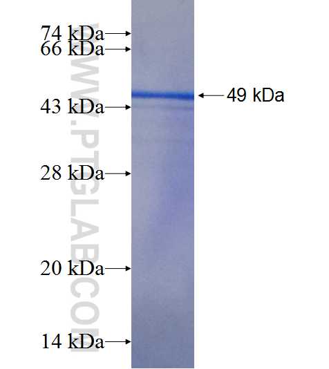 SAMD9 fusion protein Ag18787 SDS-PAGE