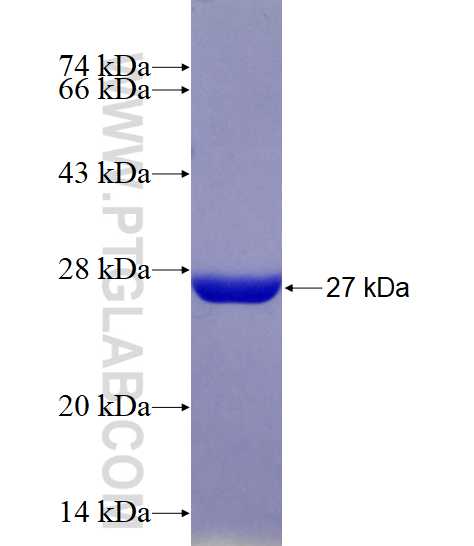 SAMD9 fusion protein Ag18971 SDS-PAGE