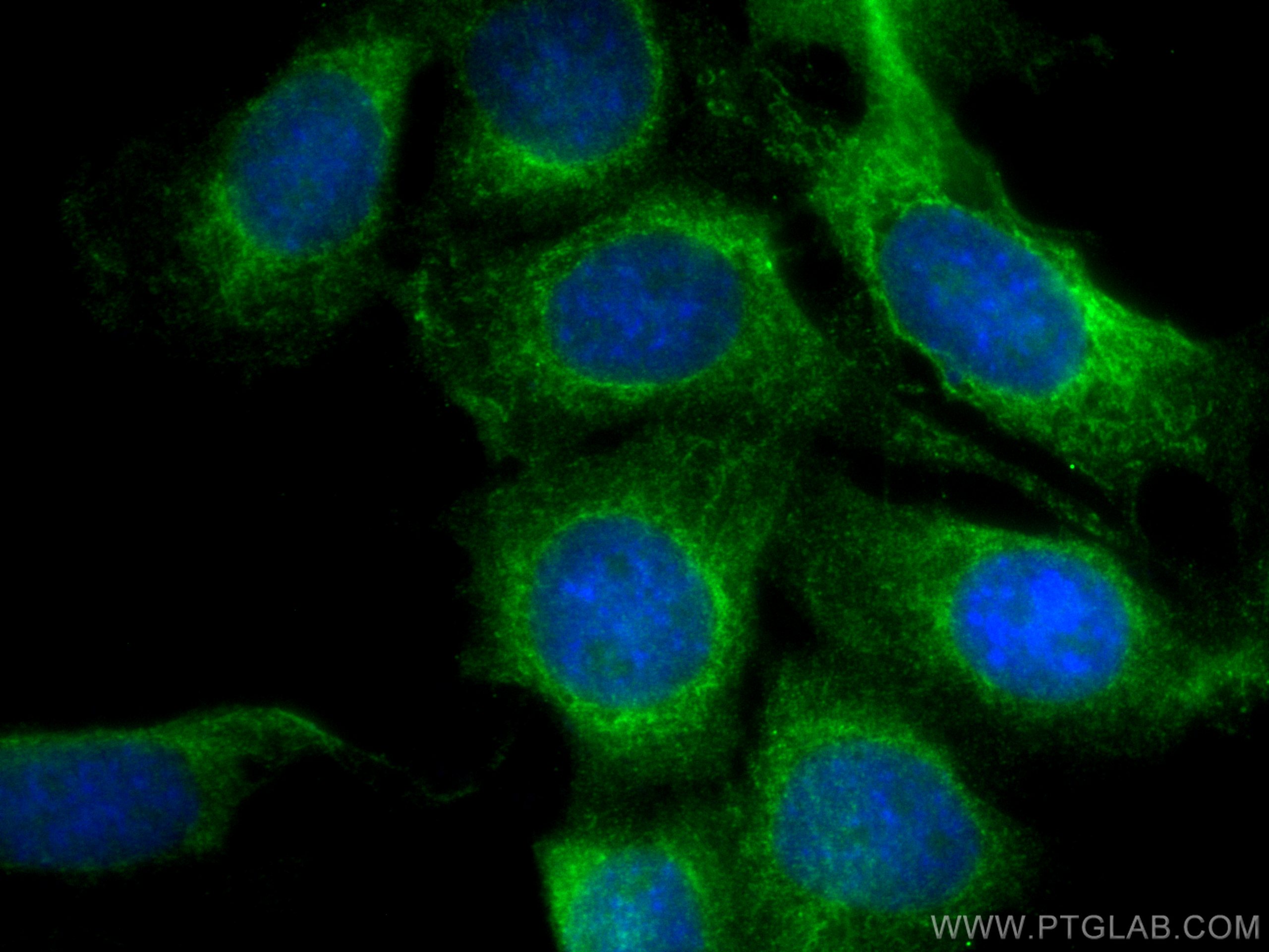 Immunofluorescence (IF) / fluorescent staining of 3T3-L1 cells using SAMD9L Polyclonal antibody (25173-1-AP)