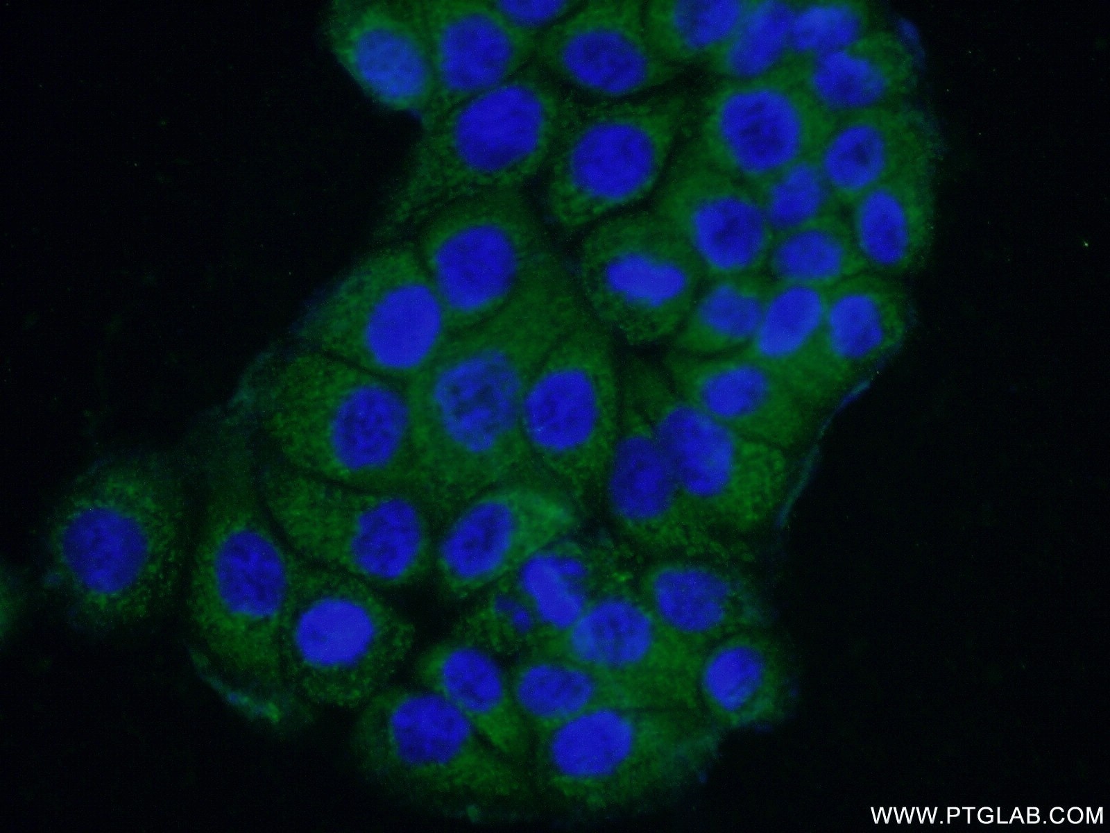 Immunofluorescence (IF) / fluorescent staining of COLO 320 cells using SAMD9L Polyclonal antibody (25173-1-AP)