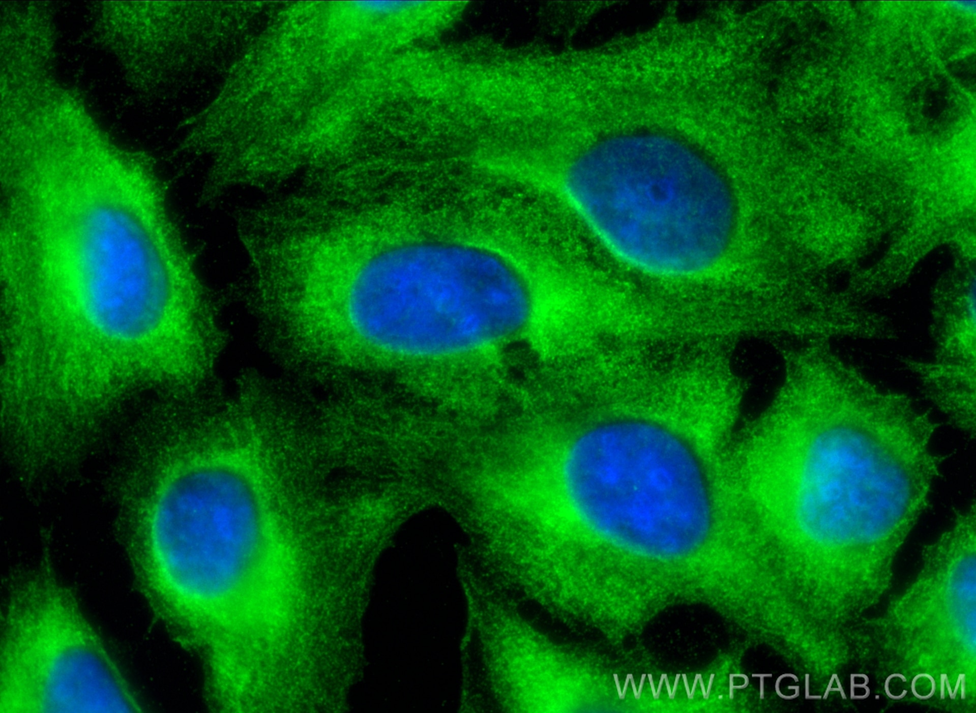 Immunofluorescence (IF) / fluorescent staining of U2OS cells using SAMD9L Polyclonal antibody (25173-1-AP)