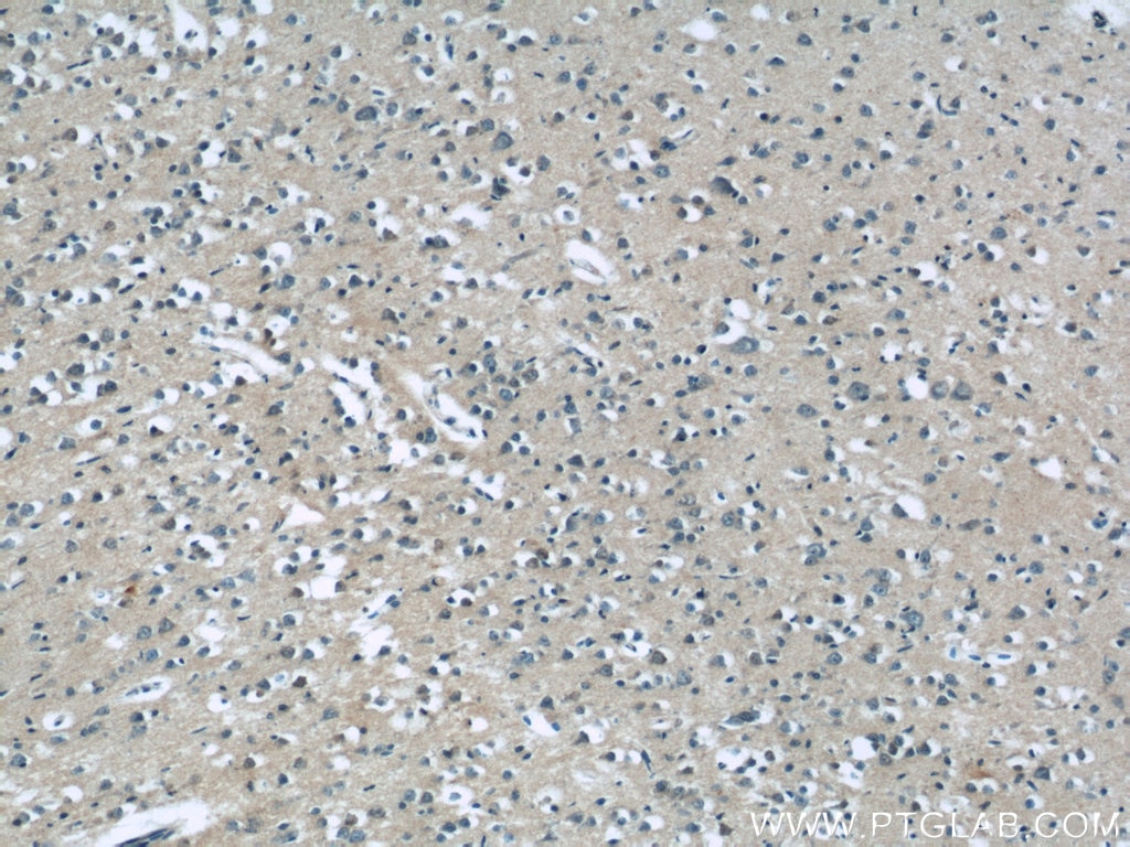 Immunohistochemistry (IHC) staining of human brain tissue using SAMD9L Polyclonal antibody (25173-1-AP)