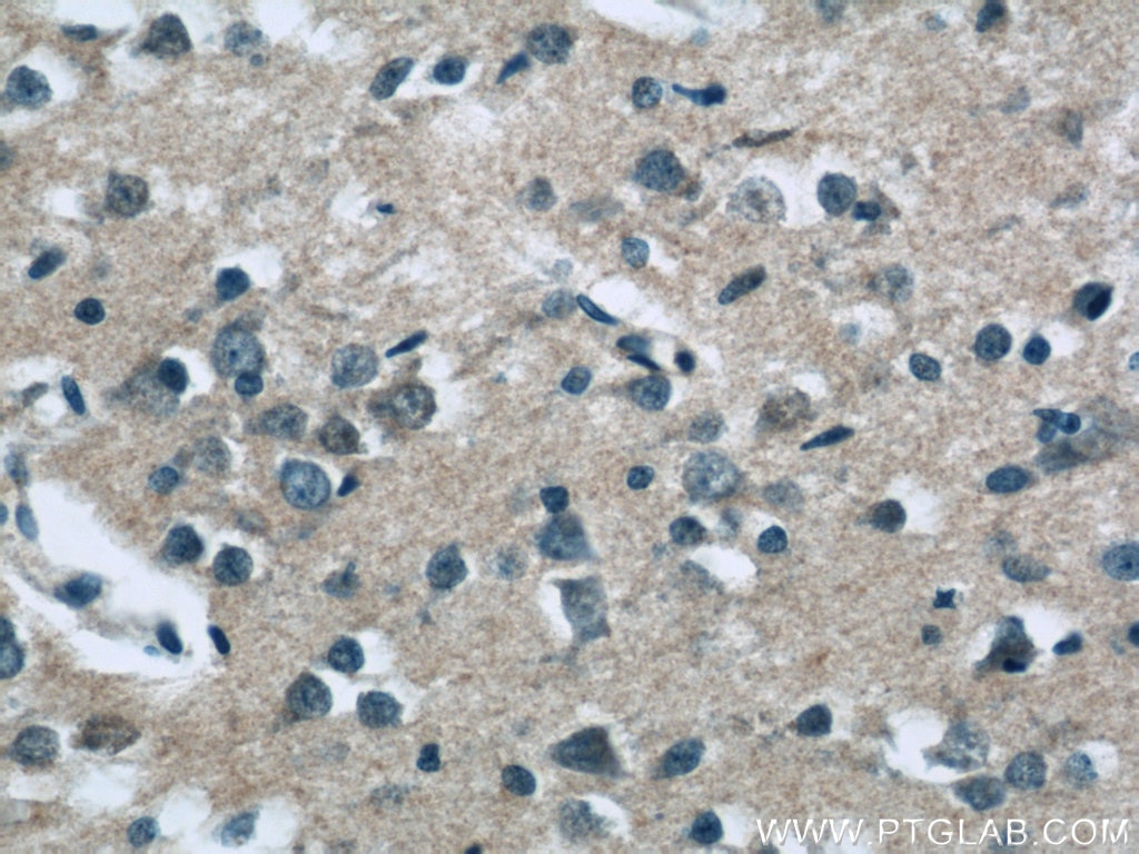 Immunohistochemistry (IHC) staining of human brain tissue using SAMD9L Polyclonal antibody (25173-1-AP)