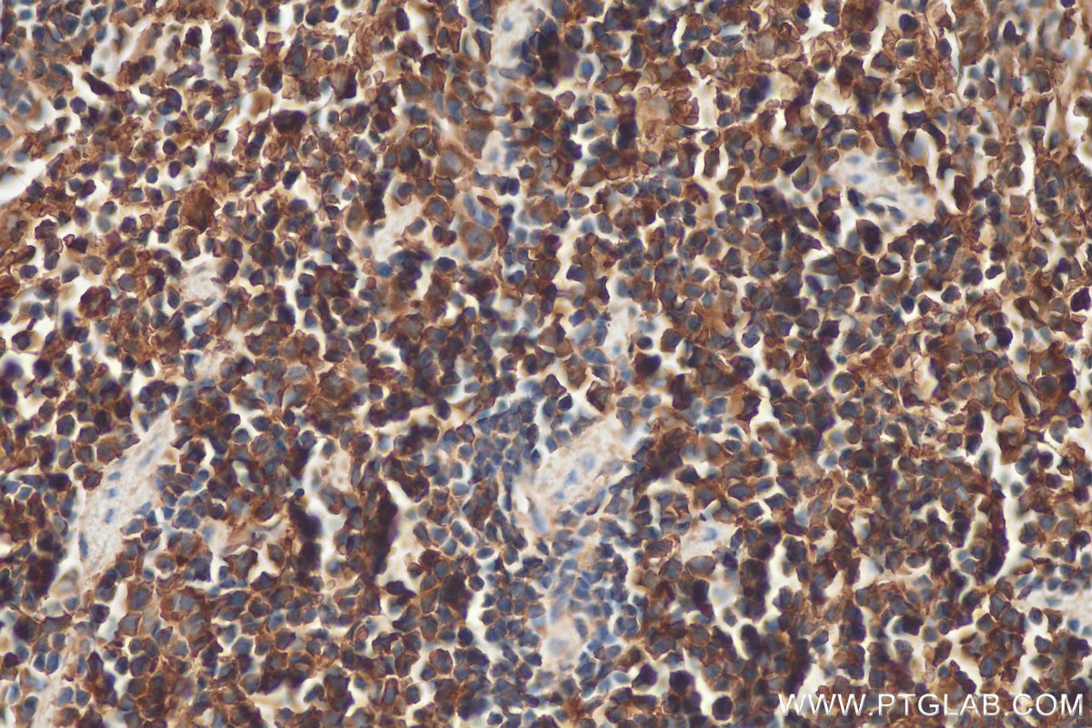 Immunohistochemistry (IHC) staining of mouse spleen tissue using SAMD9L Polyclonal antibody (25173-1-AP)
