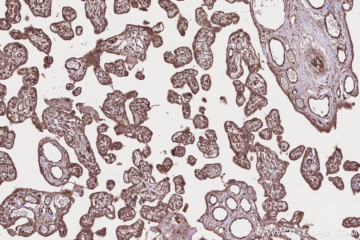 Immunohistochemistry (IHC) staining of human placenta tissue using SAMD9L Polyclonal antibody (25173-1-AP)