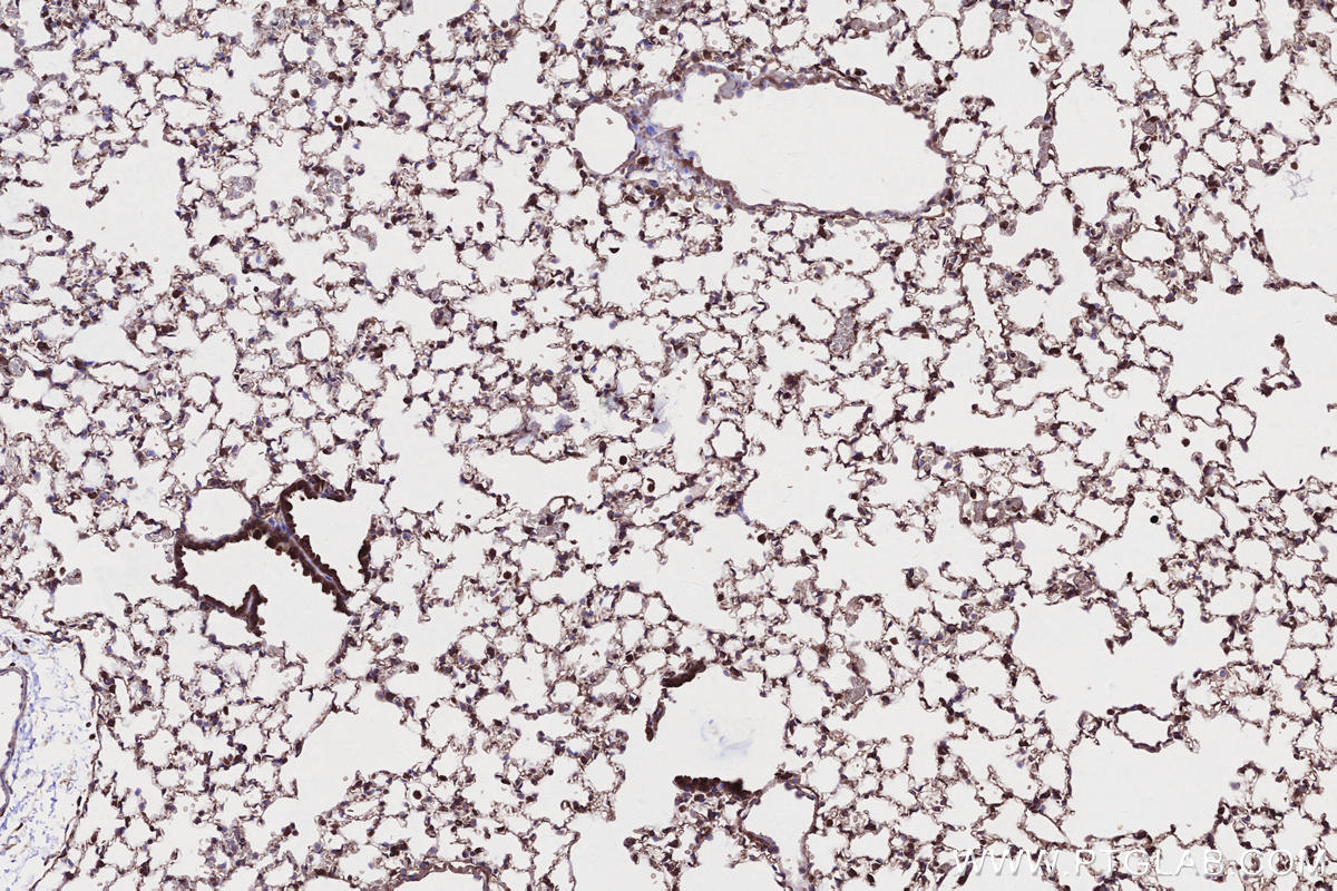 Immunohistochemistry (IHC) staining of mouse lung tissue using SAMD9L Polyclonal antibody (25173-1-AP)