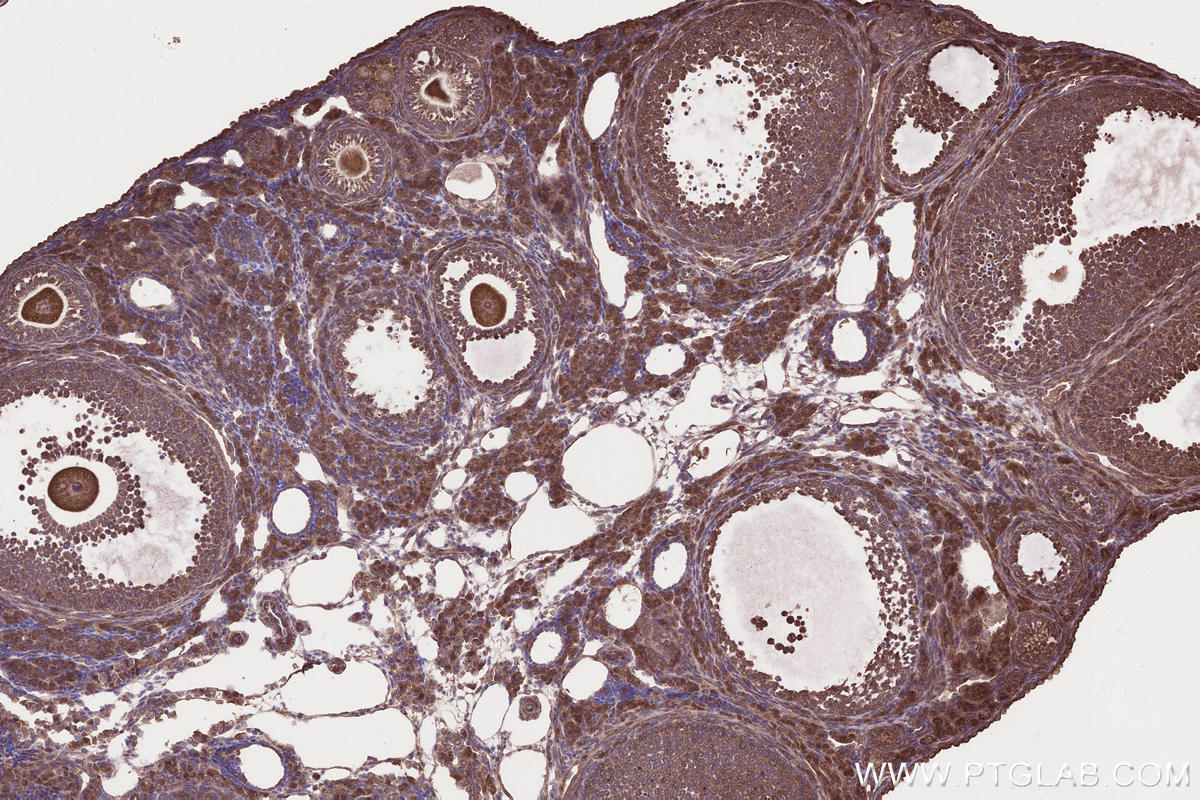Immunohistochemistry (IHC) staining of mouse ovary tissue using SAMD9L Polyclonal antibody (25173-1-AP)