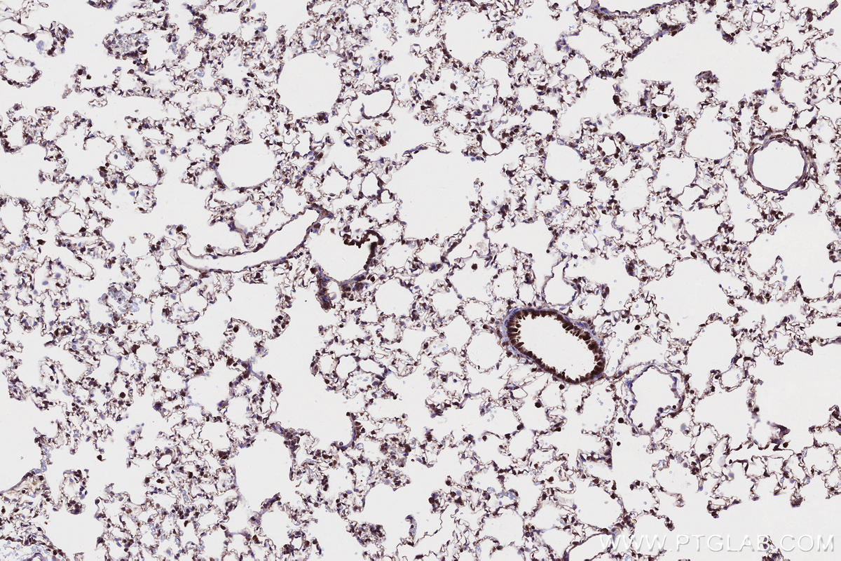 Immunohistochemistry (IHC) staining of rat lung tissue using SAMD9L Polyclonal antibody (25173-1-AP)