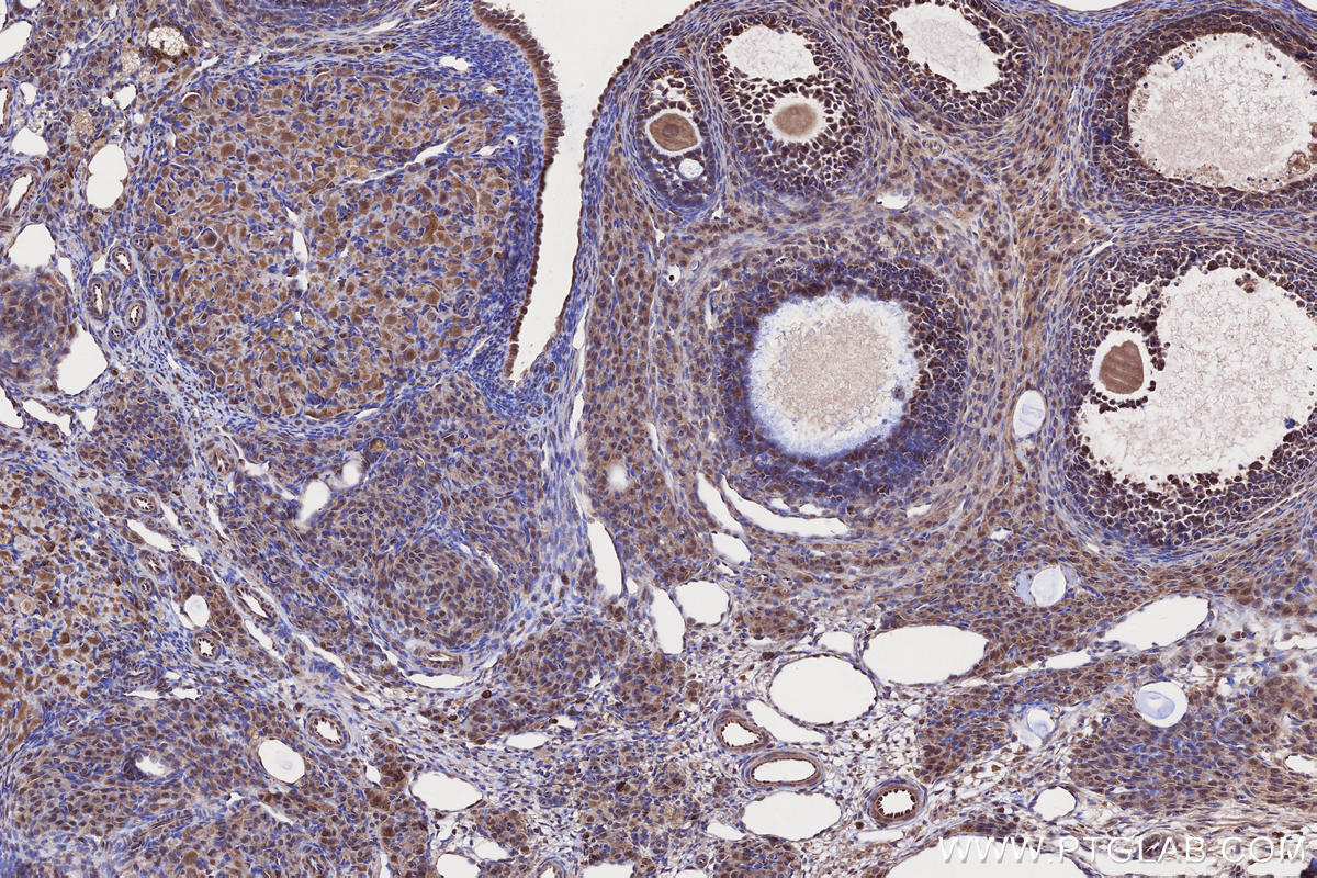 Immunohistochemistry (IHC) staining of rat ovary tissue using SAMD9L Polyclonal antibody (25173-1-AP)
