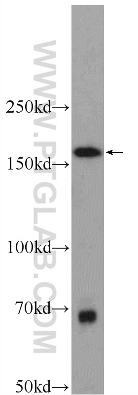 Western Blot (WB) analysis of COLO 320 cells using SAMD9L Polyclonal antibody (25173-1-AP)