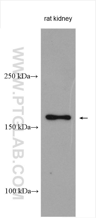 Western Blot (WB) analysis of various lysates using SAMD9L Polyclonal antibody (25173-1-AP)