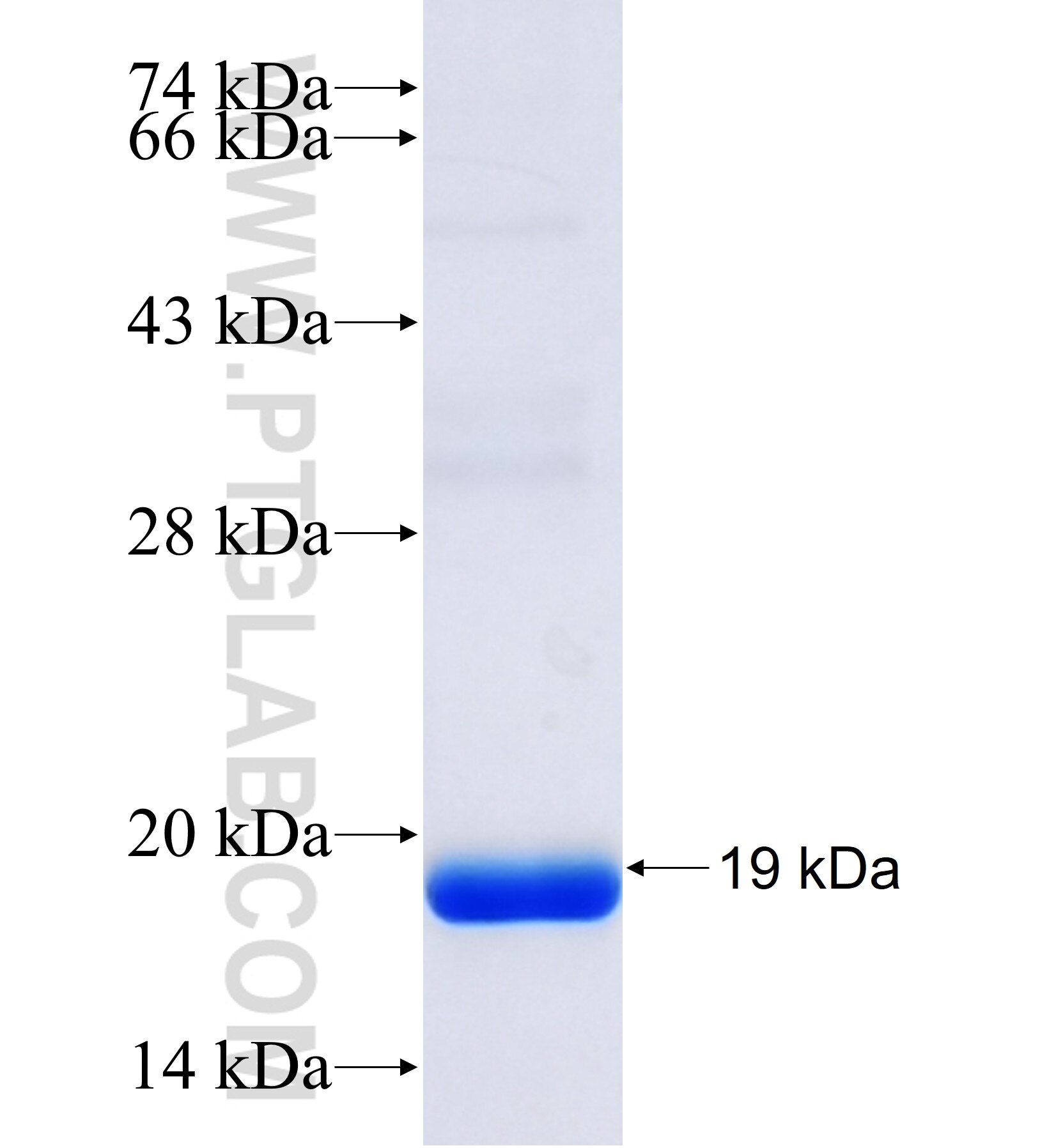 SAMD9L fusion protein Ag41454 SDS-PAGE SAMD9L fusion protein Ag41454 SDS-PAGE