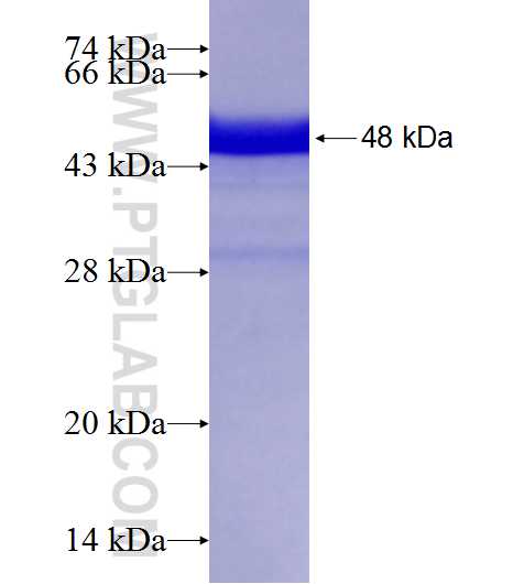 SAMD9L fusion protein Ag18541 SDS-PAGE