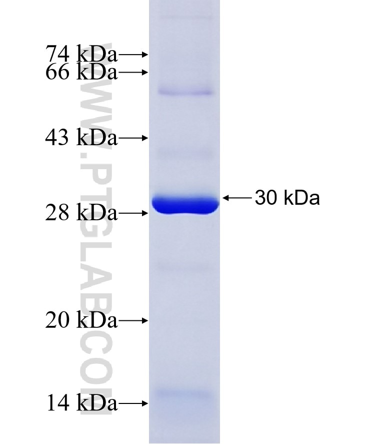 SAMD9L fusion protein Ag18641 SDS-PAGE
