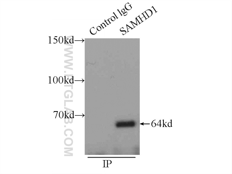 Immunoprecipitation (IP) experiment of K-562 cells using SAMHD1 Polyclonal antibody (12586-1-AP)