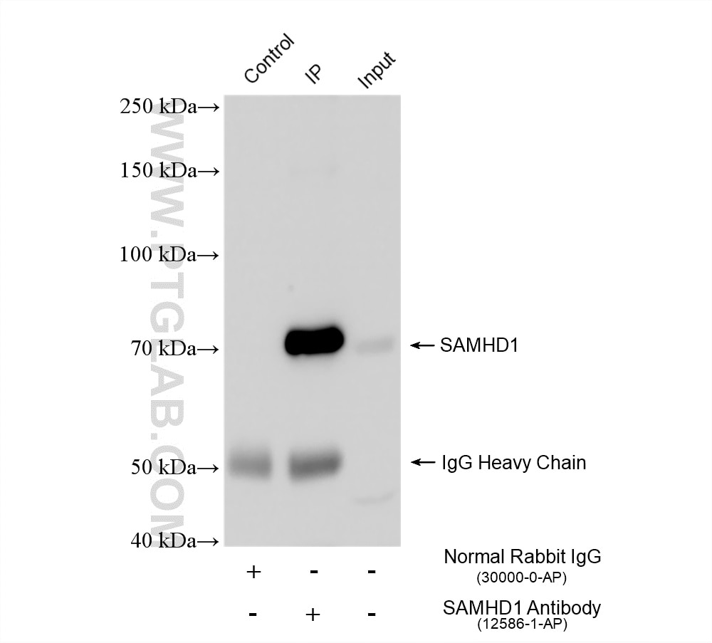 IP result of anti-SAMHD1 (IP:12586-1-AP, 4ug; Detection:12586-1-AP 1:3000) with K-562 cells lysate 2440 ug. Immunoprecipitation (IP) experiment of K-562 cells using SAMHD1 Polyclonal antibody (12586-1-AP)