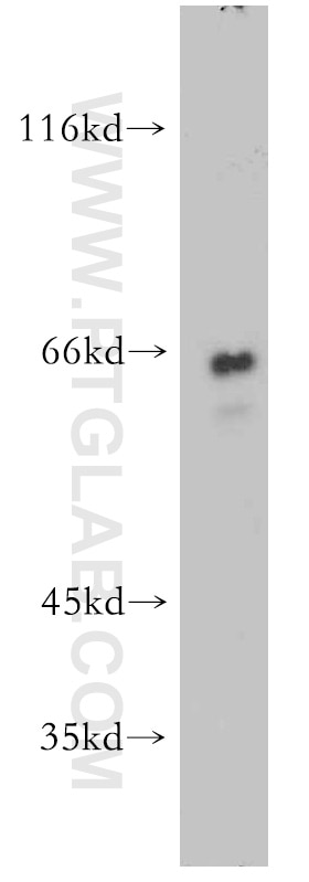 Western Blot (WB) analysis of human heart tissue using SAMHD1 Polyclonal antibody (12586-1-AP)