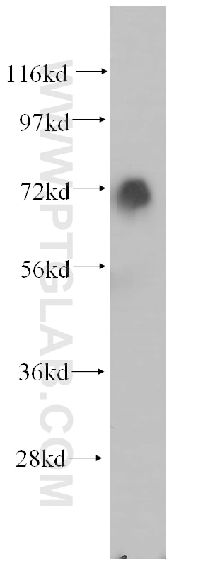 Western Blot (WB) analysis of K-562 cells using SAMHD1 Polyclonal antibody (12586-1-AP)