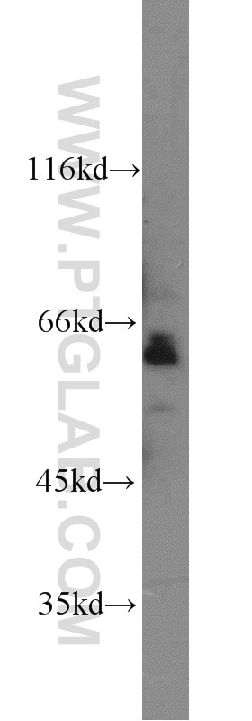 Western Blot (WB) analysis of mouse heart tissue using SAMHD1 Polyclonal antibody (12586-1-AP)