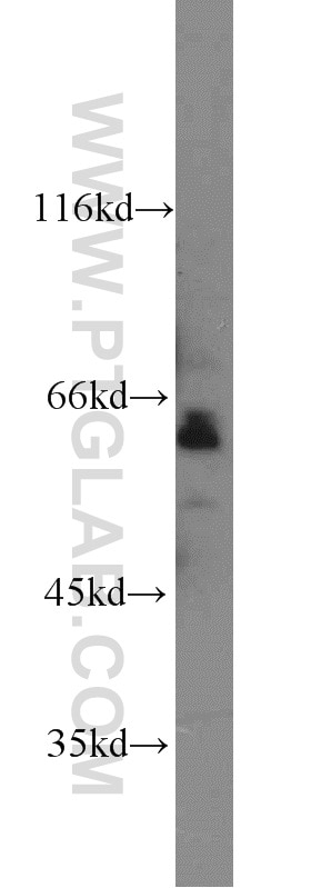 WB analysis of mouse heart using 12586-1-AP