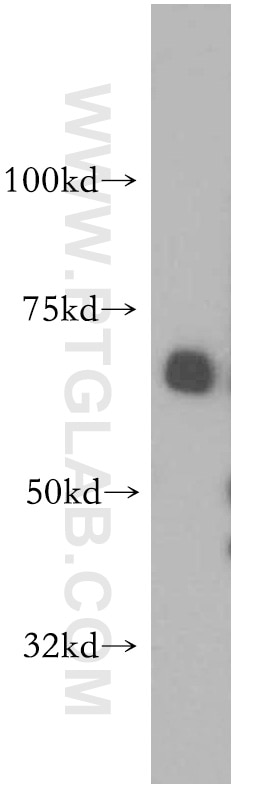 Western Blot (WB) analysis of human brain tissue using SAMHD1 Polyclonal antibody (12586-1-AP)