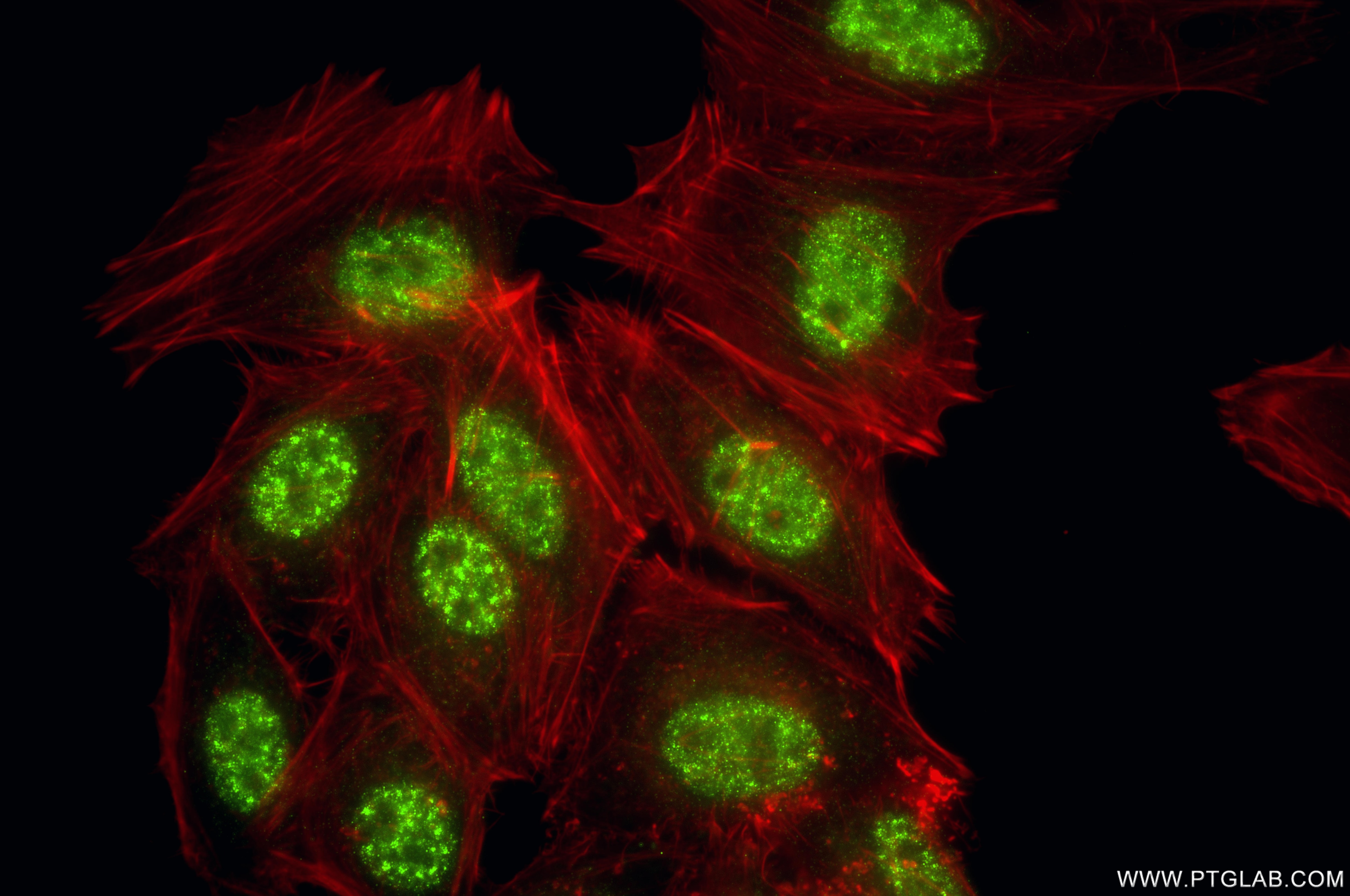 Immunofluorescence (IF) / fluorescent staining of HepG2 cells using SAMHD1 Recombinant monoclonal antibody (86798-1-RR)