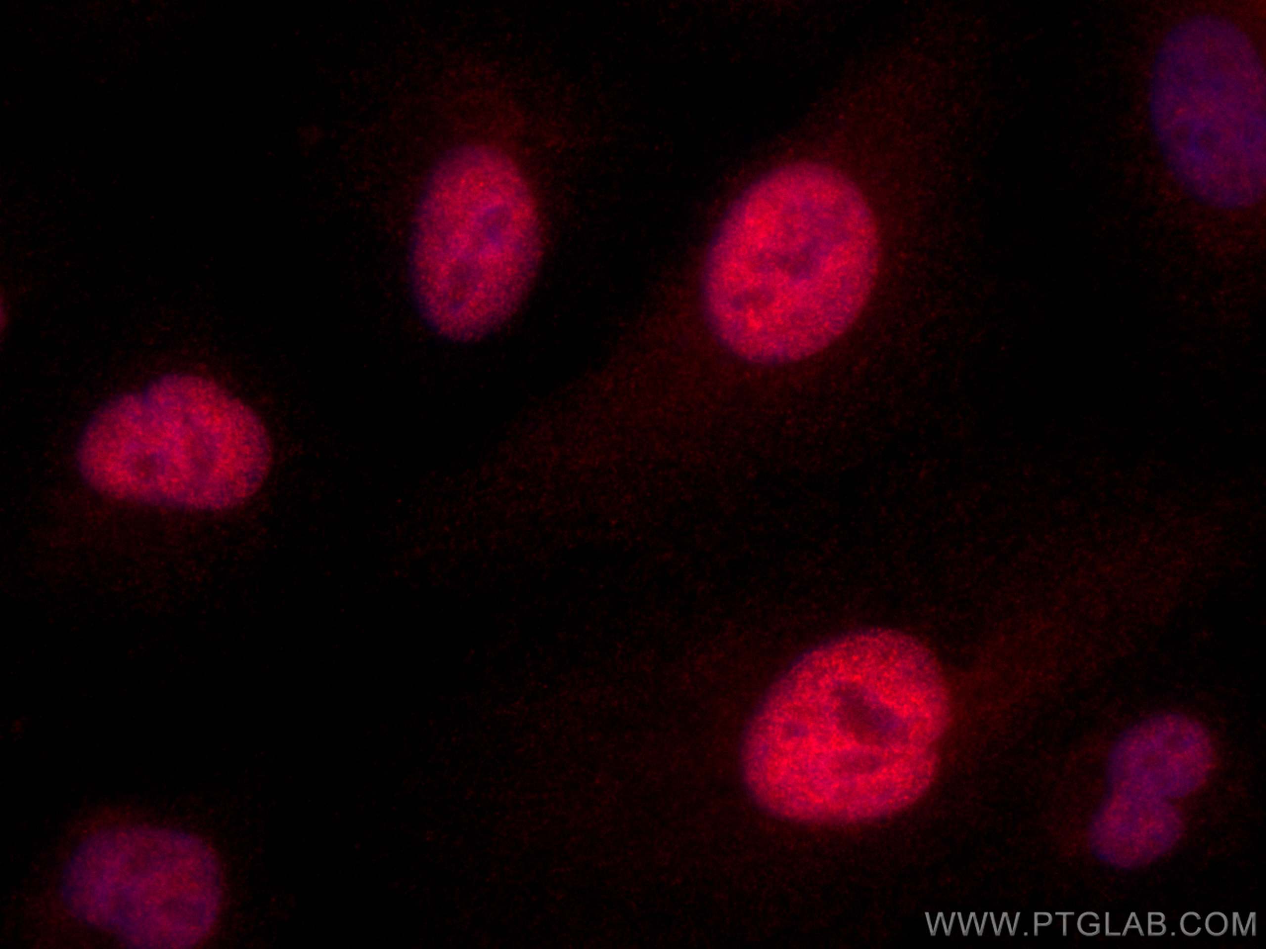 IF Staining of A549 using CL594-12586