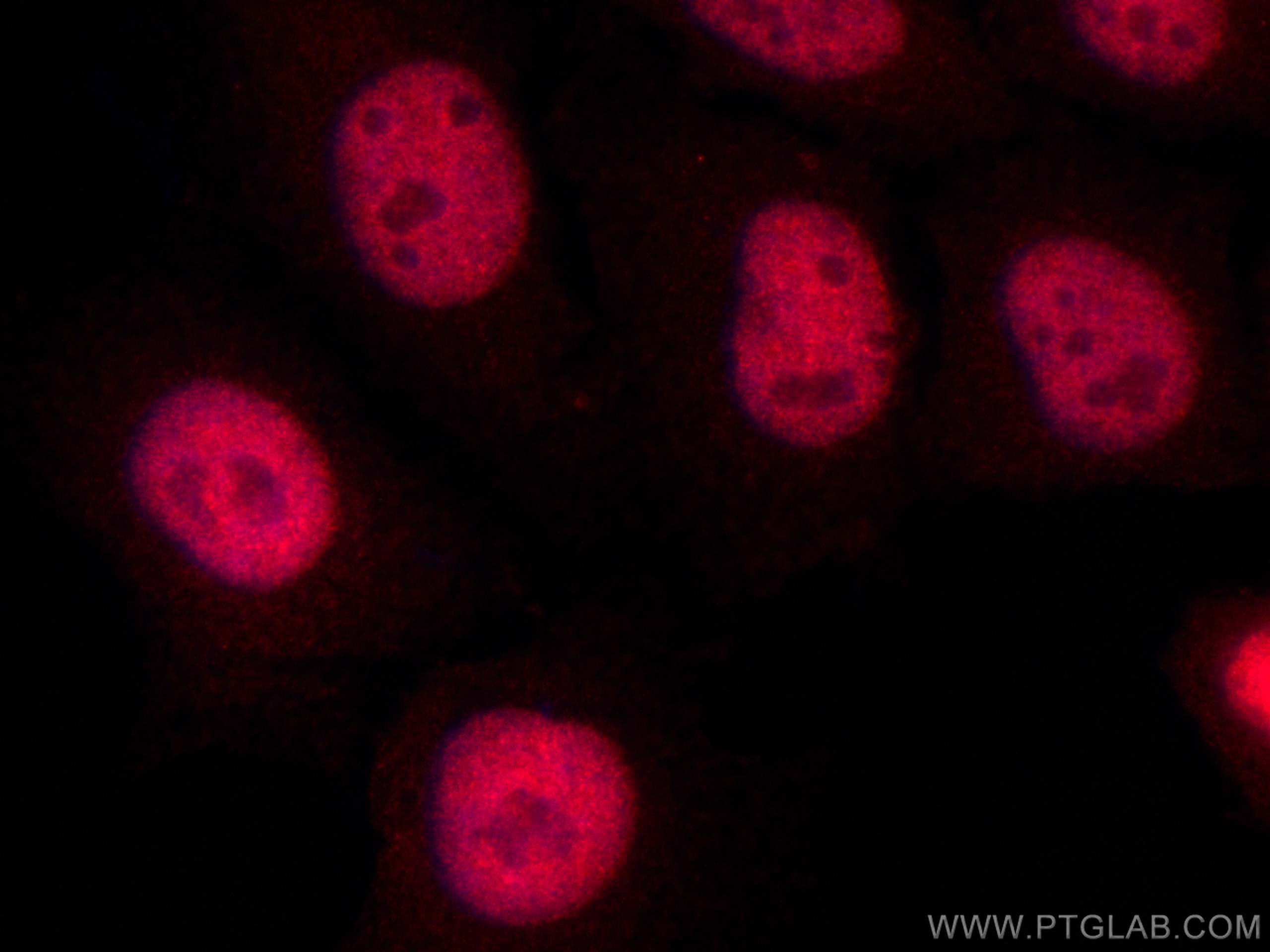 Immunofluorescence (IF) / fluorescent staining of HepG2 cells using CoraLite®594-conjugated SAMHD1 Polyclonal antibody (CL594-12586)