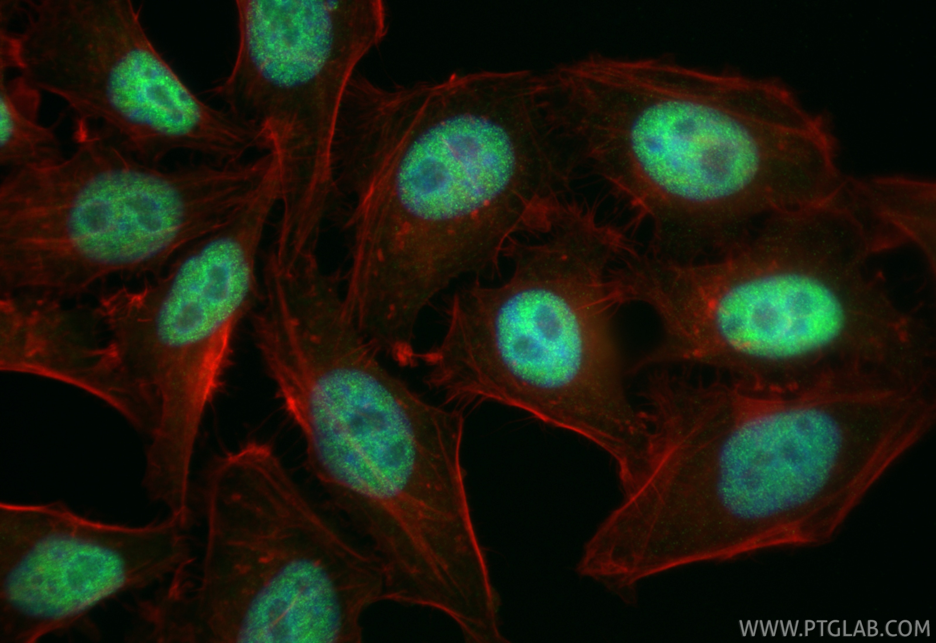 IF Staining of HepG2 using RMX00060 Immunofluorescence (IF) / fluorescent staining of HepG2 cells using Multi-rAb® SAMHD1 Multi-Recombinant antibody (RMX00060)