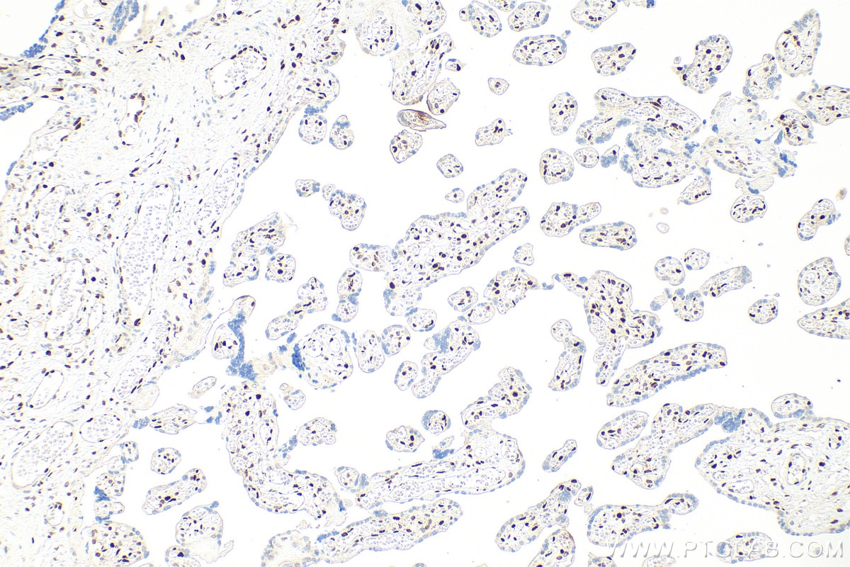 IHC staining of human placenta using RMX00060 Immunohistochemistry (IHC) staining of human placenta tissue using Multi-rAb® SAMHD1 Multi-Recombinant antibody (RMX00060)
