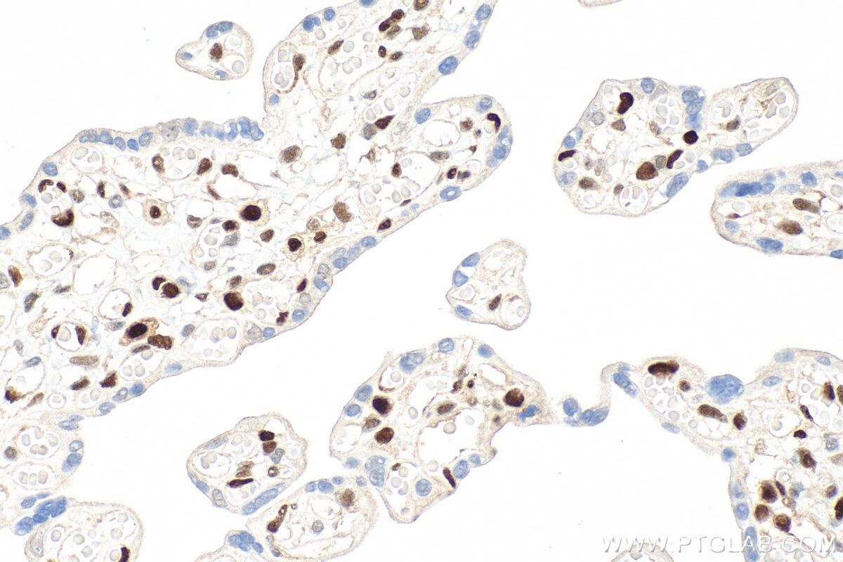 IHC staining of human placenta using RMX00060 Immunohistochemistry (IHC) staining of human placenta tissue using Multi-rAb® SAMHD1 Multi-Recombinant antibody (RMX00060)