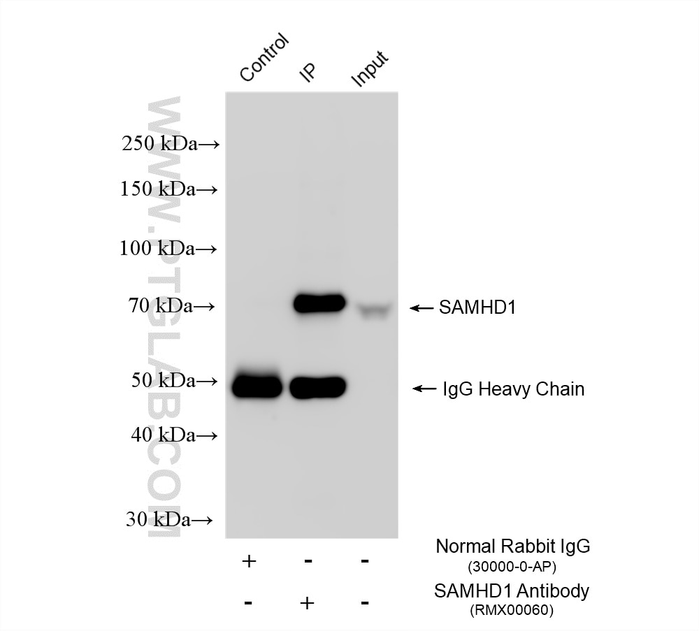 IP experiment of K-562 using RMX00060 Immunoprecipitation (IP) experiment of K-562 cells using Multi-rAb® SAMHD1 Multi-Recombinant antibody (RMX00060)