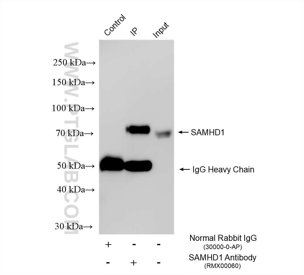IP experiment of HeLa using RMX00060 Immunoprecipitation (IP) experiment of HeLa cells using Multi-rAb® SAMHD1 Multi-Recombinant antibody (RMX00060)