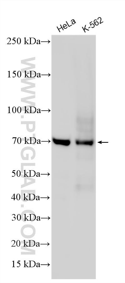 WB analysis using RMX00060 Western Blot (WB) analysis of various lysates using Multi-rAb® SAMHD1 Multi-Recombinant antibody (RMX00060)