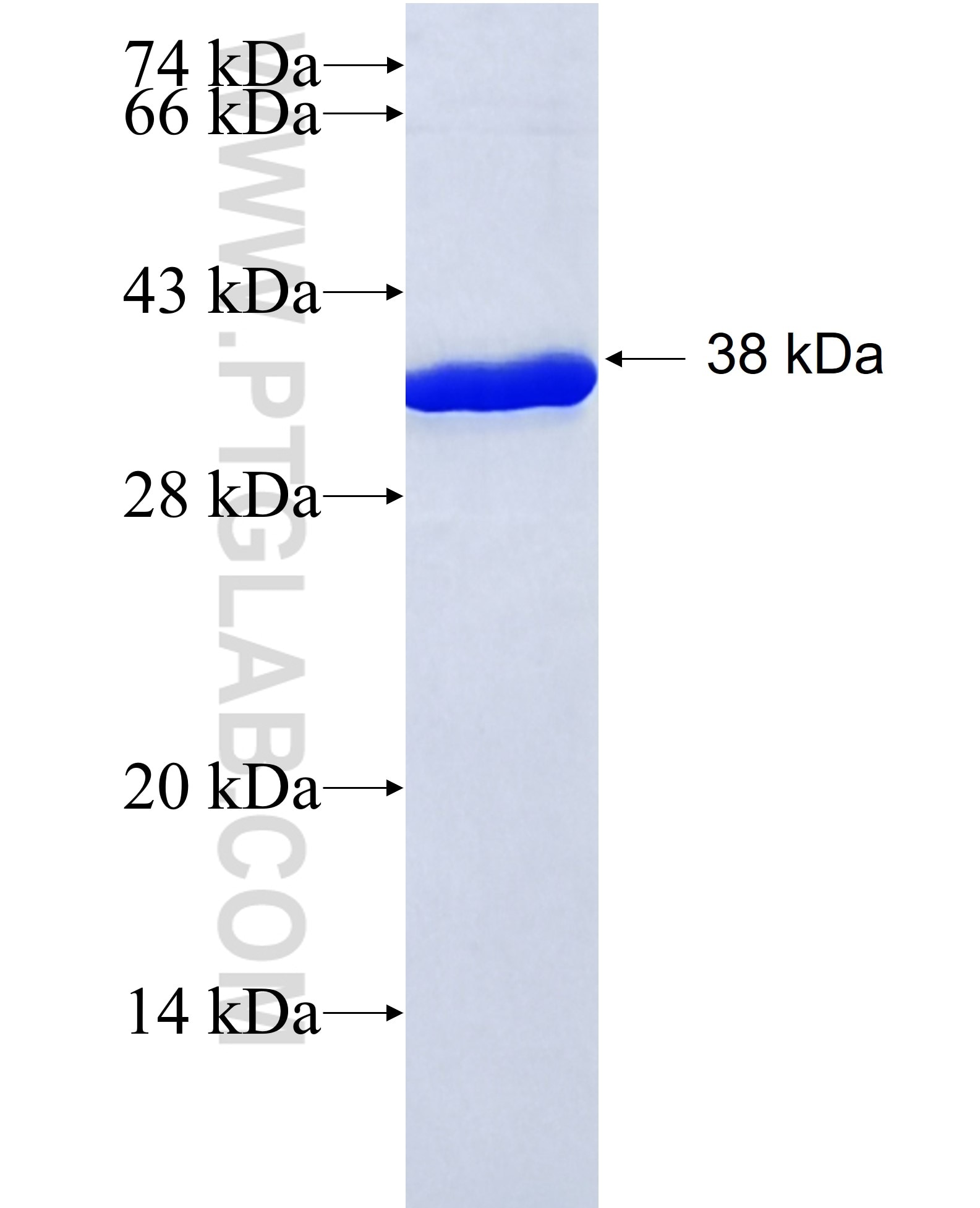 SAMHD1 fusion protein Ag18766 SDS-PAGE