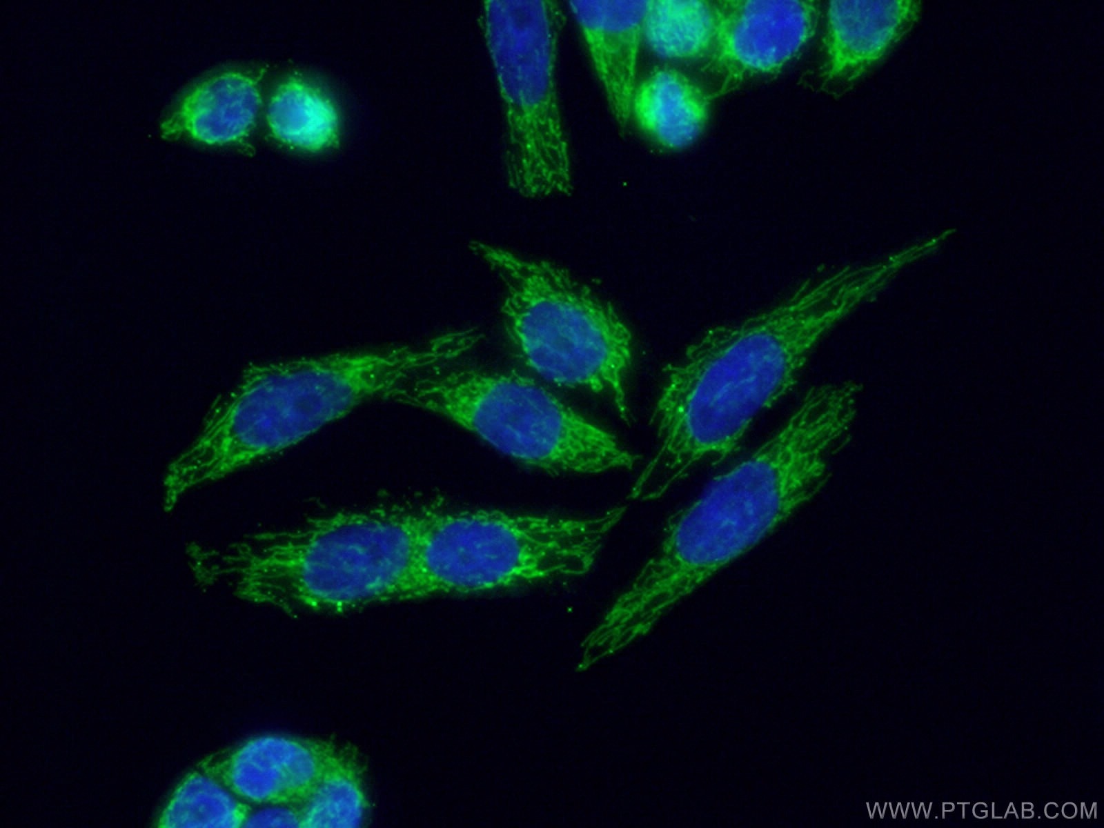 Immunofluorescence (IF) / fluorescent staining of HeLa cells using Sam50 Polyclonal antibody (20824-1-AP)