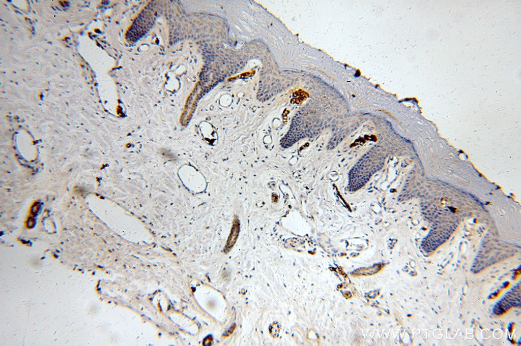 IHC staining of human skin using 20824-1-AP