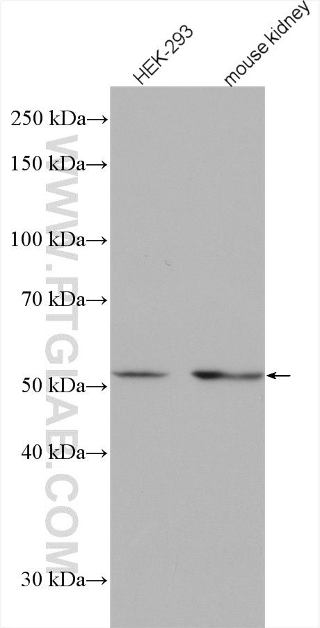 Western Blot (WB) analysis of various lysates using Sam50 Polyclonal antibody (20824-1-AP)