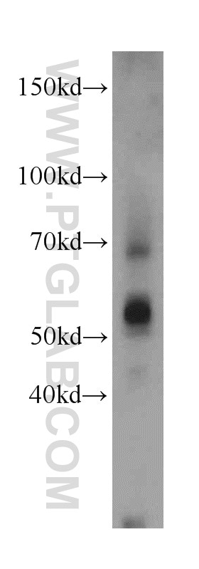 Western Blot (WB) analysis of mouse ovary tissue using Sam50 Polyclonal antibody (20824-1-AP)