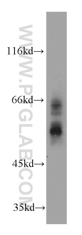 Western Blot (WB) analysis of A375 cells using Sam50 Polyclonal antibody (20824-1-AP)