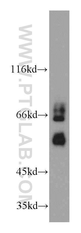 Western Blot (WB) analysis of HEK-293 cells using Sam50 Polyclonal antibody (20824-1-AP)